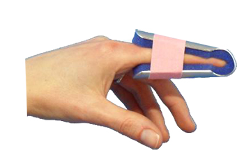 STECCA PER FRATTURA DITA A CAMPANA FARMASPLINT MISURA GRANDE PREFORMATA IN ALLUMINIO MODELLABILE CON IMBOTTITURA IN SPUGNA POLIURETANICA ANTIALLERGICA RADIOTRASPARENTE 15 CM - Farmaciapacini.it