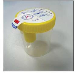 KIT CONTENITORE URINA SECUR BOX TAPPO GIALLO A VITE CON PUNTO DI PRELIEVO 120 ML 1 PEZZO - Farmaciapacini.it